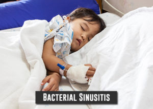 Bacterial-Sinusitis