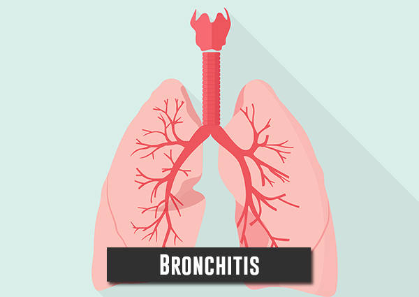 Bronchitis